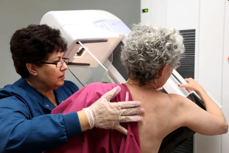 For more than three decades, experts have hotly debated the best age to start breast cancer screening,