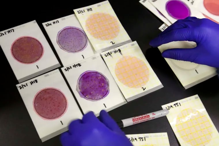 Associate scientist Kyle Boyar checks petri films of cannabis samples that are undergoing testing at SC Labs in Santa Cruz, Calif., on Feb. 24, 2015. (Patrick Tehan/Bay Area News Group/TNS)