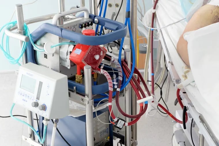 The ECMO machine replaces the function of the heart and lungs in critically ill patients.