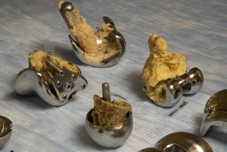 At Drexel University, researchers study knee implants that were removed from patients, with bits of bone and cement still attached.