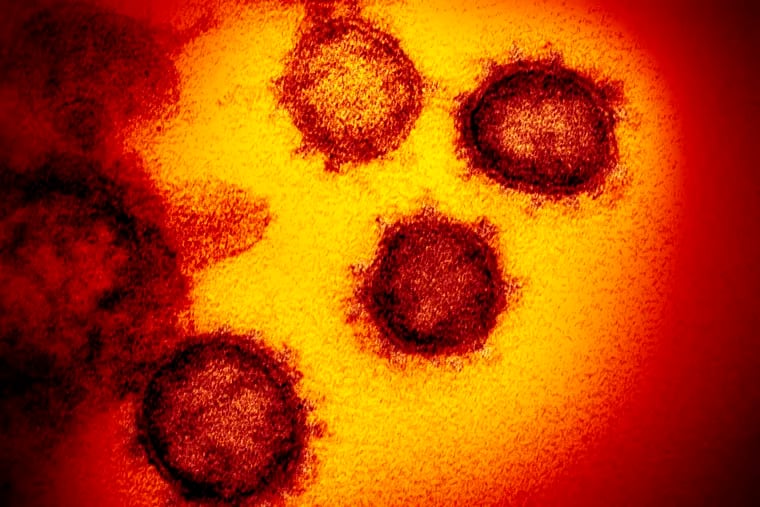 Several coronavirus particles are shown in this undated electron microscope image from the U.S. National Institutes of Health. The sample was isolated from a patient in the United States.