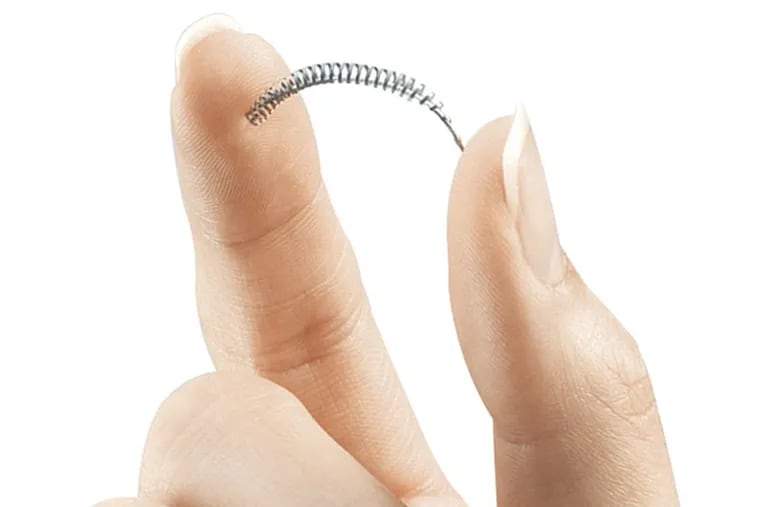 The Essure coils are implanted in the fallopian tubes to cause scarring that leads to sterilization. (Bayer Healthcare Pharmaceuticals via AP)