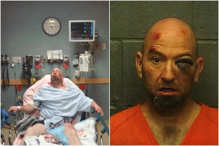 Steven Stadler at the hospital the night of his arrest,  from March 13, 2013, and in his mugshot.
