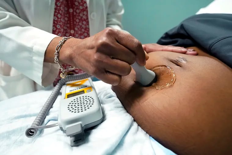 A doctor uses a hand-held Doppler probe on a pregnant woman to measure the heartbeat of the fetus in Jackson, Miss.