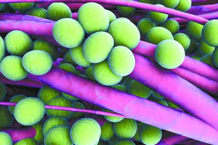 MRSA (methicillin-resistant Staphylococcus aureus) is an antibiotic-resistant staph strain posing considerable danger to the U.S. and other nations.