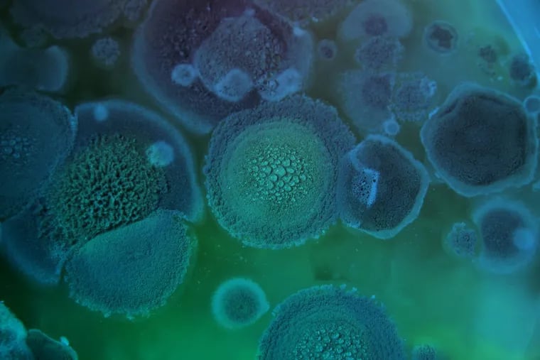 Aspergillus, shown here in an enhanced image, is the most common form of mold found in the Philadelphia area.