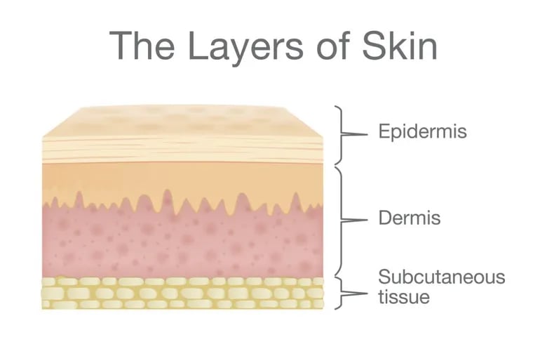 The 7-year-old boy’s genetically engineered skin adhered so well, doctors say, because his dermis was still intact. That may not be the case for burn patients.