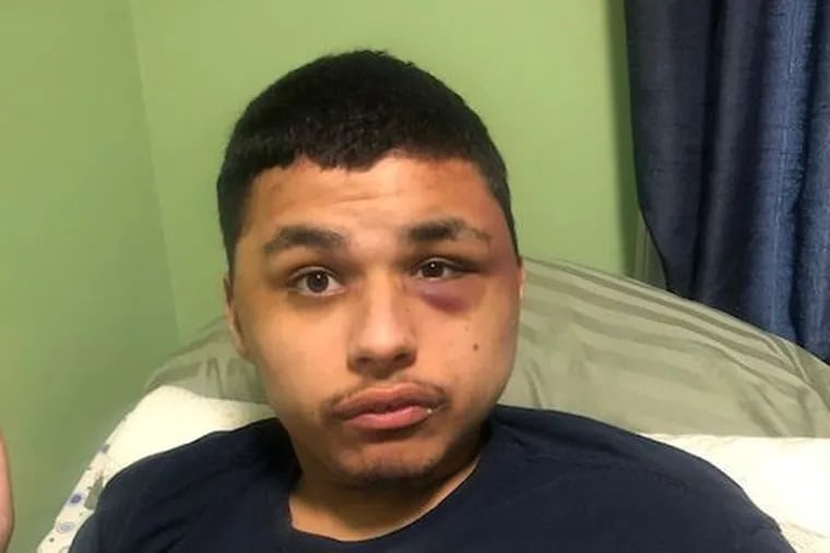 Nicholas Diaz, a 21-year-old with autistic and seizure disorders, acted out last summer when staffers at Woods Services in Langhorne denied him a snack. The result was a beating that left the young man with a black eye and other injuries to his face, neck, and arms, according to a federal lawsuit against Woods. Woods denied the allegations.