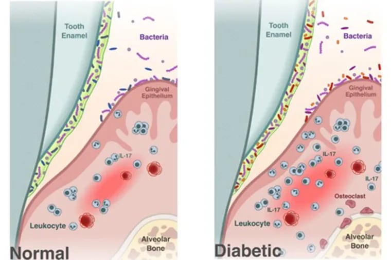 Images show the dental differences between healthy mice and those with diabetes.