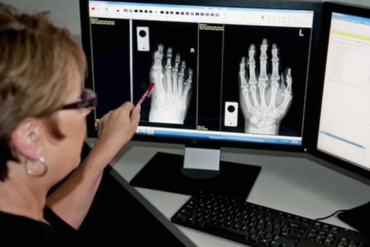 BioClinica's Pamela Luers checks images of a foot and hand.