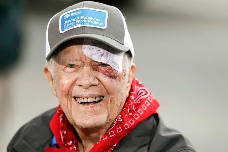 Former President Jimmy Carter answers questions during a news conference at a Habitat for Humanity project on Oct. 7, in Nashville, Tenn. , the day after falling at home.  The fall required a dozen stitches. He had turned 95 the previous week.  (AP Photo/Mark Humphrey)