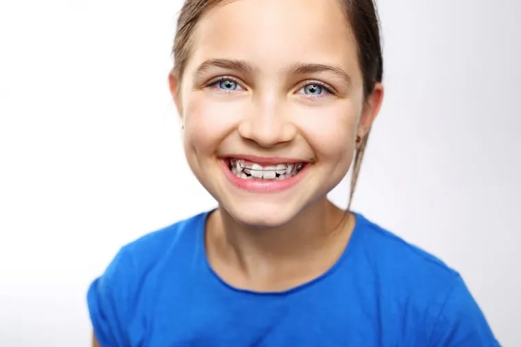 Young girl with orthodontic appliance.