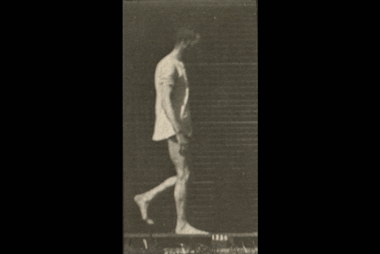 A neurologist has discovered medical records for this mystery man and eight other patients that Eadweard Muybridge photographed at the University of Pennsylvania in 1885.
