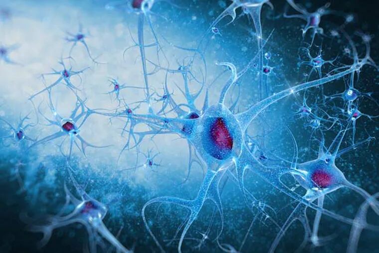 Researchers have discovered a defect in a key cell-signaling pathway they say contributes to both overproduction of toxic protein in the brains of Alzheimer's disease patients as well as loss of communication between neurons. (Photo courtesy Fotolia/TNS)