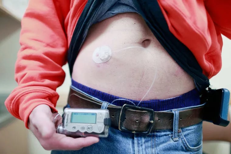 Jeff Bargull wears an insulin pump. Bargull has to make four or five purchases of insulin a year. During the recession, when his hours were cut, insurance cost less than insulin.