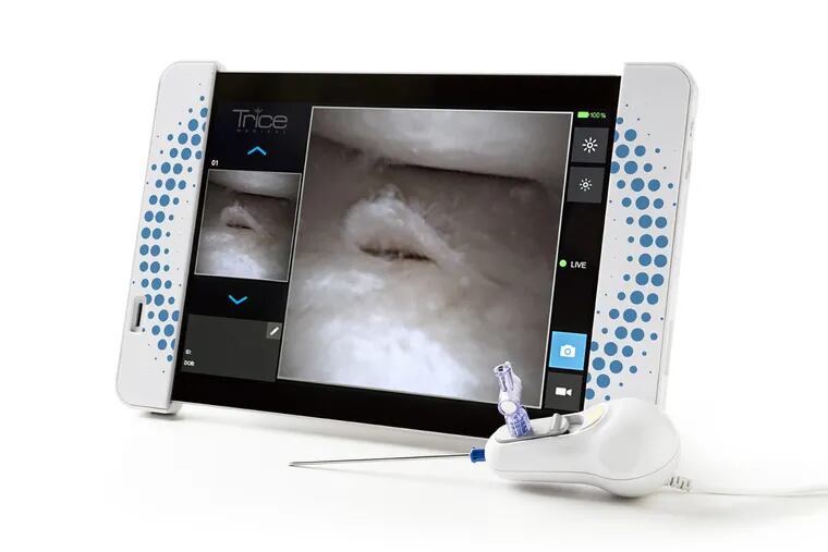 Trice Medical's Mi-Eye enables doctors to diagnose a sports-related injury in the office, without an MRI. It consists of a hypodermic needle with a small camera tethered to a Microsoft surface tablet that shows high-definition pictures. In this case, a meniscus tear.