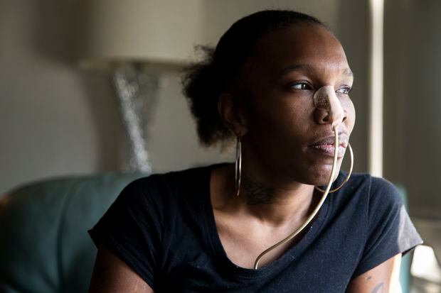 She was shot in the face but didn’t die: ‘I felt like my whole face exploded’ | Helen Ubiñas