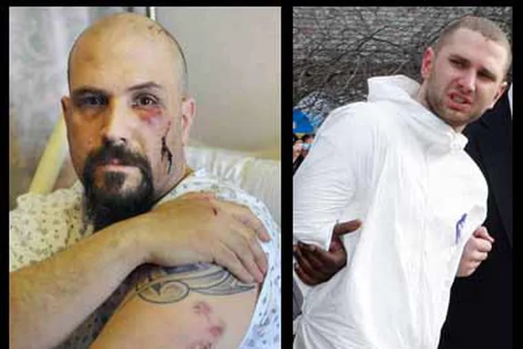 Joseph Lozito of Northeast Philadelphia shows wounds he received in his struggle with stabbing suspect Maksim Gelman, right. (New York Daily News; David Karp / Associated Press)