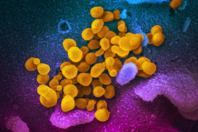 This electron microscope image made available by the U.S. National Institutes of Health shows SARS-CoV-2, or coronavirus, yellow, emerging from the surface of cells, blue/pink, cultured in the lab.