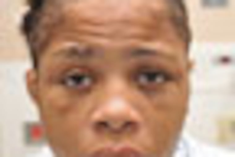 Beatrice Weston is seen here in a Philadelphia hospital after she was rescued by police from a Northeast Philadelphia house in October 2011. Beatrice, Linda Ann Weston’s niece, testified in Municipal Court on Tuesday, Dec. 20, 2011, that Linda Weston had repeatedly beaten her. This photo shows scars and bruises to her face. The photo was entered into evidence as part of Linda Weston and her co-defendants’ two-day preliminary hearing on Dec. 19 and 20, 2011.
Photo: Given to us because it was entered into evidence. (NO CREDIT NEEDED.)