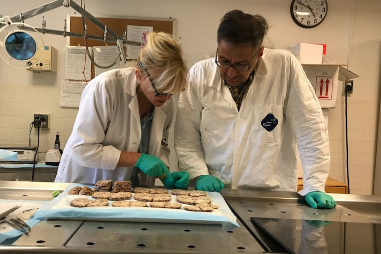 Ann McKee, Director of the Boston University CTE Center, and neuropathologist Victor Alvarez conduct the post-mortem study of the brain of former NFL player Aaron Hernandez.