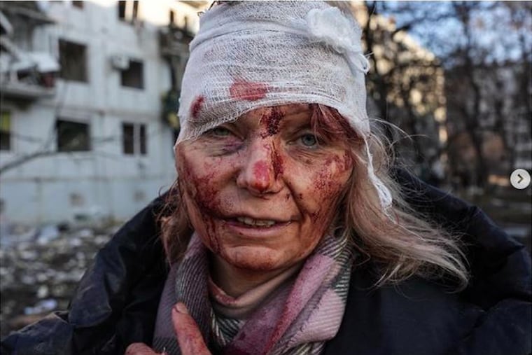 The photo of Helena’s bandaged face stared out at the world on Friday morning — one of the first victims of the Russian invasion of Ukraine that the world saw on the front pages of dozens of newspapers. Philadelphia-based freelance photographer Wolfgang Schwan was one of the first journalists on scene to document her survival.