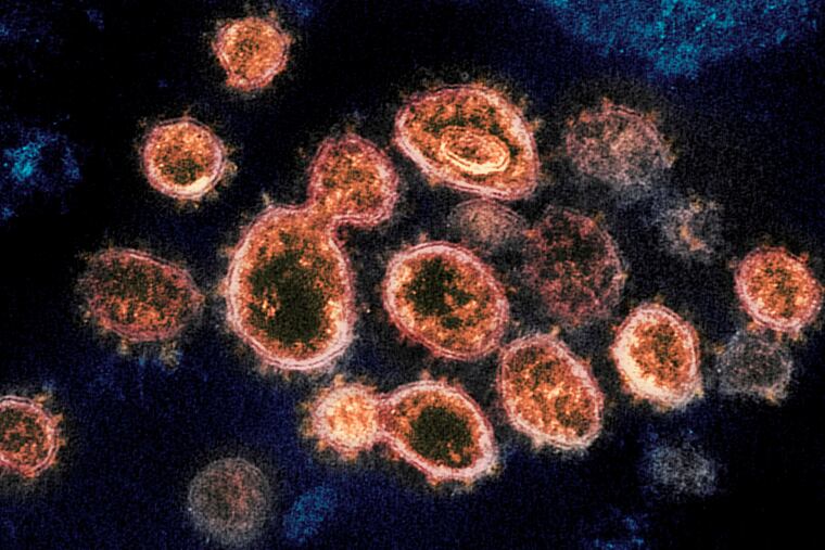 This transmission electron microscope image shows SARS-CoV-2, the virus that causes COVID-19, isolated from a patient in the U.S.