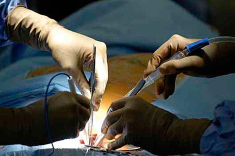 Penn surgeons operate on Ralph Miller. Two years after gettinga new heart valve, Miller is no longer so easily short of breath. (Ron Tarver/Staff)