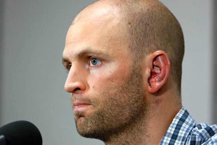 Toronto Blue Jays pitcher J.A. Happ attends a news conference prior to the Blue Jays' baseball game against the Tampa Bay Rays, Wednesday, May 8, 2013, in St. Petersburg, Fla. Happ was released Wednesday from a hospital, the day after he was hit on the head hit by a line drive from Tampa Bay Rays' Desmond Jennings. (AP Photo/Mike Carlson)