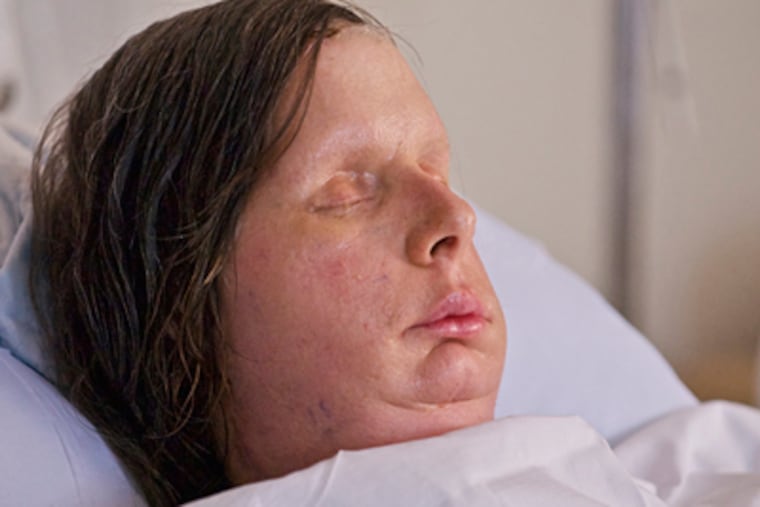 Charla Nash was mauled by a chimp in 2009. Doctors at a Boston hospital have given her a new appearance. (Brigham & Women's Hospital)