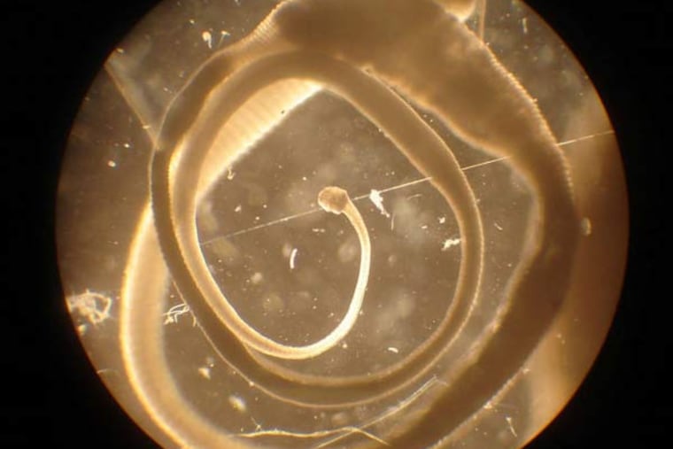 The adult stage of "Hymenolepis diminuta," a small helminth. The worm is used therapeutically only in its larval stage.