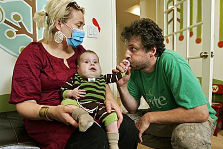 Jennifer Bertrand holds 7-month-old son Winston, who gets a kiss from dad Chris Bertrand at their home in Olathe, Kansas. Winston, the Bertrands' only child, was born Feb. 20 with lymphatic and venous malformations in his neck, face and chest that create large and small masses in his cheeks and jaw line. (Tammy Ljungblad / Kansas City Star / MCT)