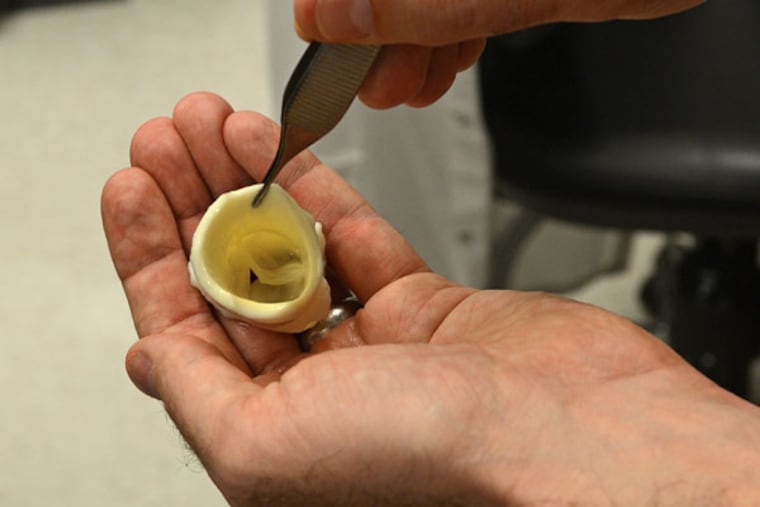 Physicians and researchers at the Mayo Clinic in Rochester say they see the future of medicine: a smorgasbord of technology that can be used to tap the body's innate ability to heal itself. Dr. Daniel Spoon is working with a bioreactor and a bioprinter with which he hopes to print heart valves. Here, he holds some pig heart valves, Junes 5, 2013, in Rochester, Minnesota. (Richard Sennott/Minneapolis Star Tribune/MCT)