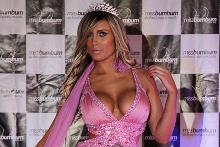 In March, Brazilian model Andressa Urach, 27, runner-up in that country's "Miss BumBum" contest, was readmitted to a hospital there with an infection from silicone injections in her buttocks. (AP Photo/Nelson Antoine, File)