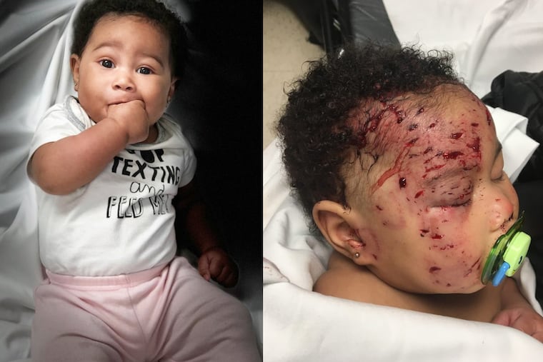 Journi Black before and after she was attacked by a raccoon