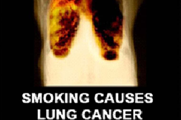 Phila. Board of Health wants signs like New York City's; its mandate is tied up in court.