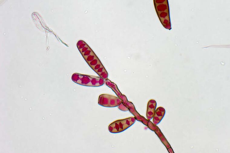 The exserohilum rostratum fungus is a common cause of fungal meningitis.