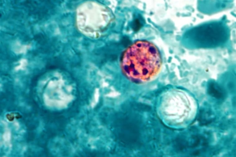 A photomicrograph of a fresh stool sample reveals the presence of four Cyclospora cayetanensis oocysts. Centers for Disease Control and Prevention official are tracking a number of cyclosporiasis cases caused by this parasite.