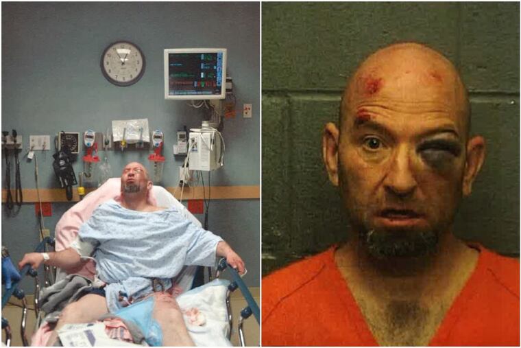Steven Stadler at the hospital the night of his arrest, from March 13, 2013, and in his mugshot.