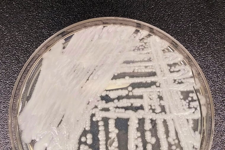 A strain of Candida auris is shown cultured in a petri dish at a Centers for Disease Control and Prevention laboratory. In a paper published March 20, CDC researchers noted that U.S. cases of the dangerous fungus tripled over just three years, and more than half of states, including Pennsylvania, have reported cases.