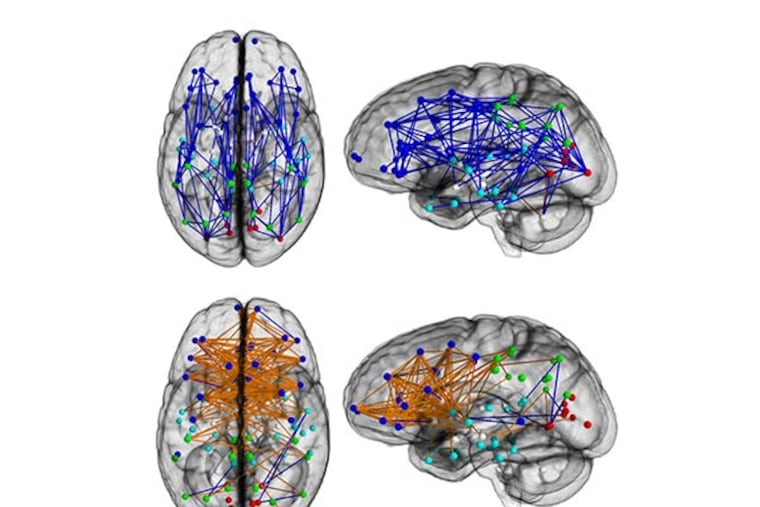 Brain networks show increased connectivity from front to back and within one hemisphere in males (upper) and left to right in females (lower). (Image courtesy Ragini Verma, PhD, Proceedings of National Academy of Sciences)