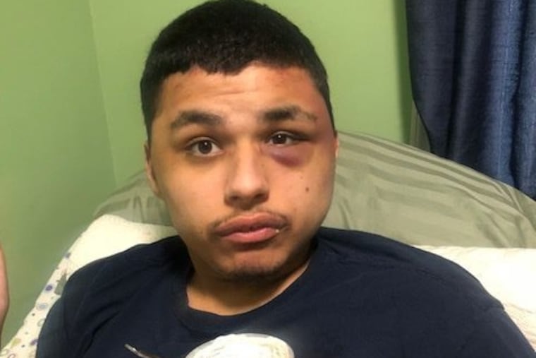 Nicholas Diaz, a 21-year-old with autistic and seizure disorders, acted out last summer when staffers at Woods Services in Langhorne denied him a snack. The result was a beating that left the young man with a black eye and other injuries to his face, neck, and arms, according to a federal lawsuit against Woods. Woods denied the allegations.