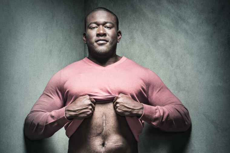 Christopher Roberts of New York City was diagnosed at age 28 with stage IV colon cancer. He is one of a dozen young colorectal cancer survivors featured in On the Rise magazine.