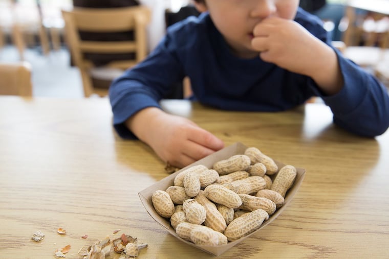 A growing body of evidence supports introducing peanut-based foods to infants to prevent peanut allergies.