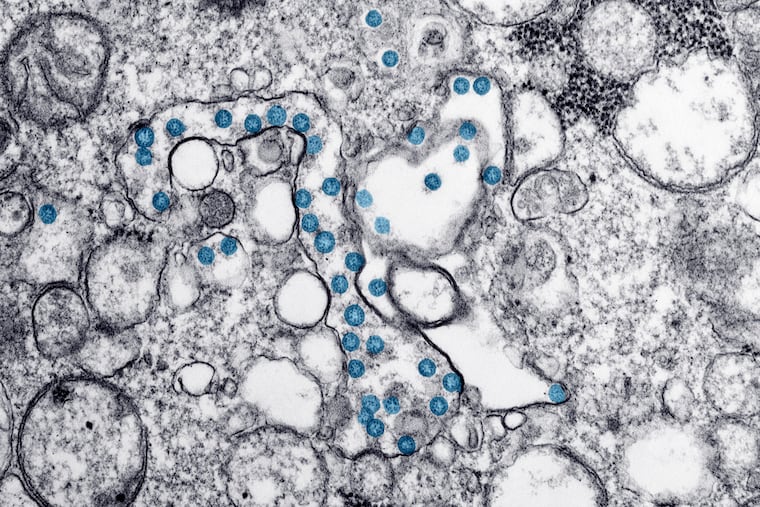 This 2020 electron microscope image made available by the U.S. Centers for Disease Control and Prevention shows the spherical particles of the new coronavirus, colorized blue, from the first U.S. case of COVID-19.