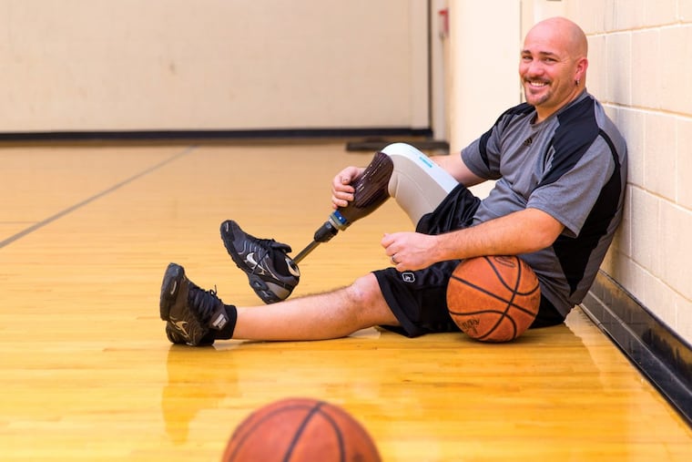 Prostheses are life-changing but sweat buildup in silicone liners can force some users to set them aside to cool down before sores develop. A Widener University researcher will study the effectiveness of a heat-absorbing liner marketed by the Ohio Willow Wood Company. CREDIT: Photo courtesy of WillowWood.