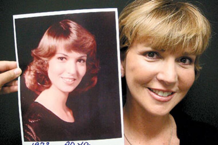 Plastic surgery patient Wendy Gell, 62, displays a photo of herself taken in 1973. "I told Dr. Baker I wanted something as minimal as possible," she said.