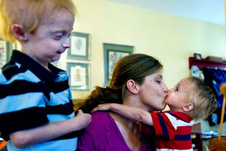 Phyllis Falcone at home in Springfield, Montgomery County, with sons Nathan, 7, and Bennett, 3. The boys have a form of progeria so rare, they are the only people in this country diagnosed with the disease. "How can you accept something this hard," she says, "when the worst is still to come?" (Sharon Gekoski-Kimmel / Staff Photographer)