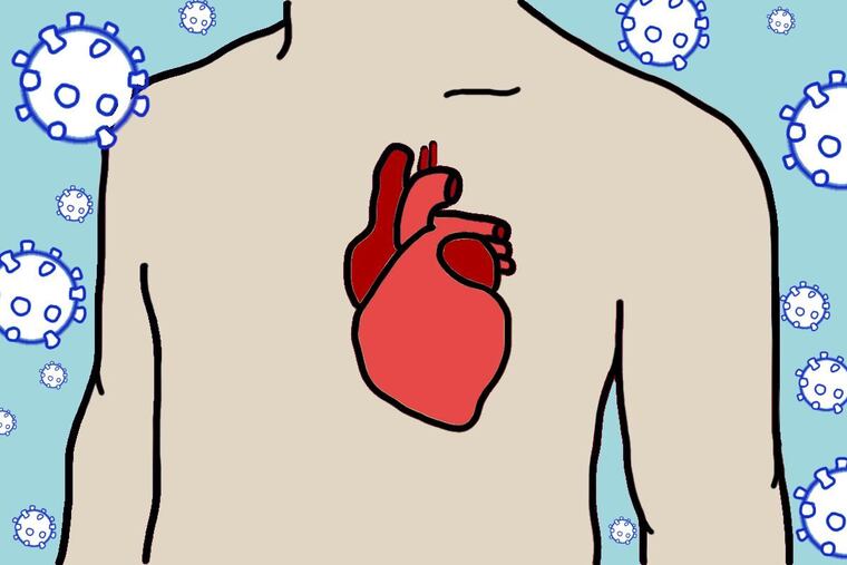 The number of heart surgeries plunged during the first COVID-19 surge, a new study finds. Some patients may have been reluctant to seek help for chest pain and other signs of heart trouble, authors said.