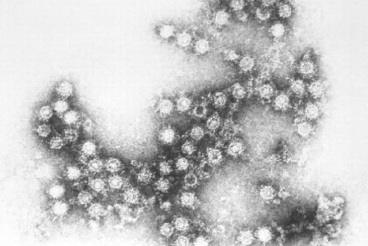 Health officials have detected a virus called enterovirus D68 in many patients afflicted with a condition called acute flaccid myelitis, which is marked by muscle weakness or paralysis in at least one limb.